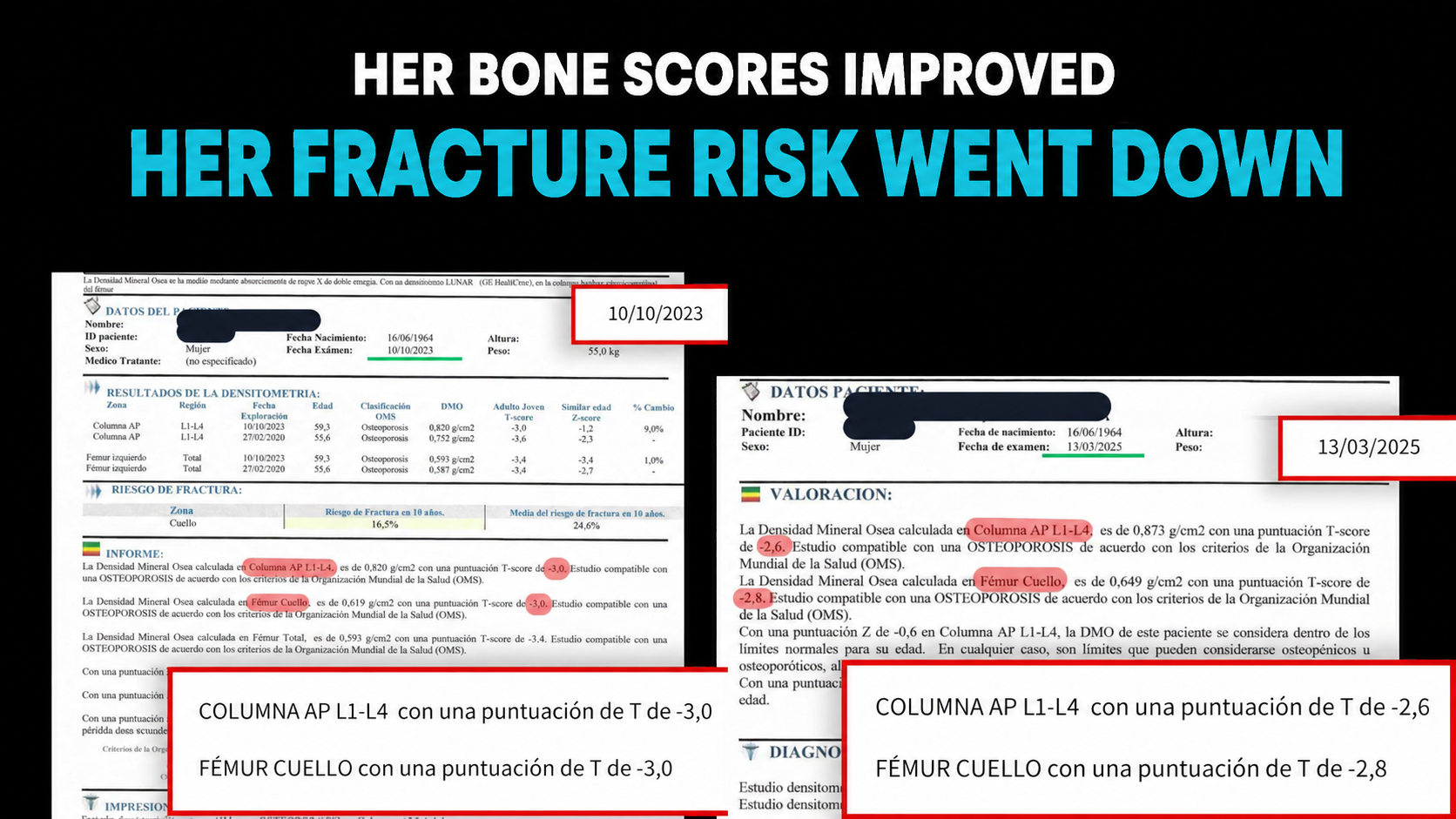 Comparative bone-density scan: patient with osteoporosis (T -2.7) rebuilding bone